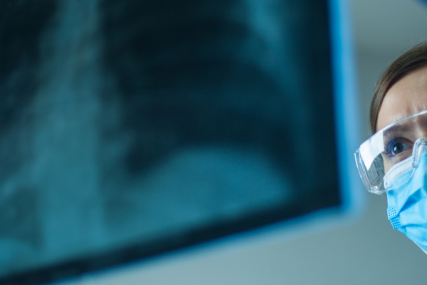 Exploring the Marvel of Low-Dose X-Rays in Healthcare
