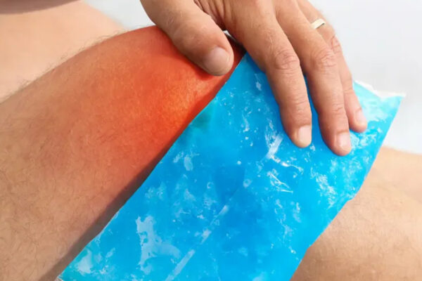 What Is The RICE Method for Injuries?